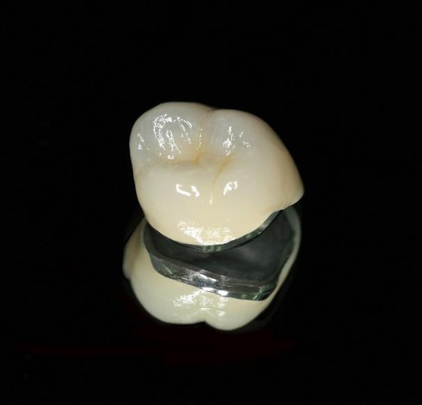 porcelain-metal-crowns-dental-treatment-in-turkey-europe-dental